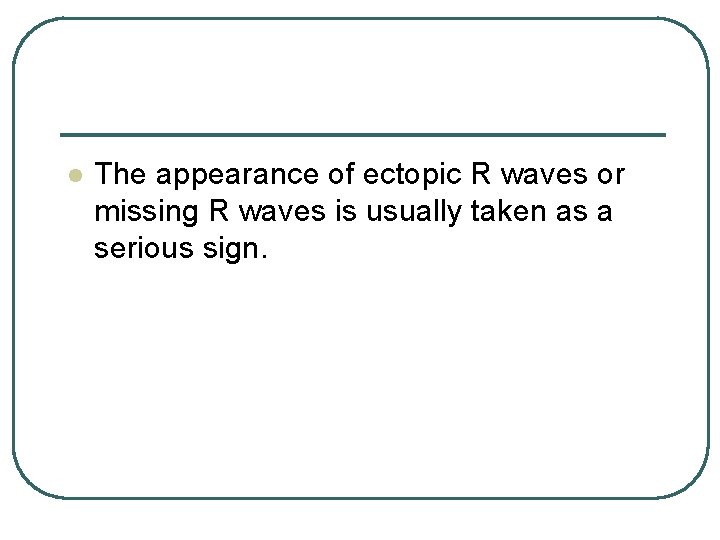 l The appearance of ectopic R waves or missing R waves is usually taken