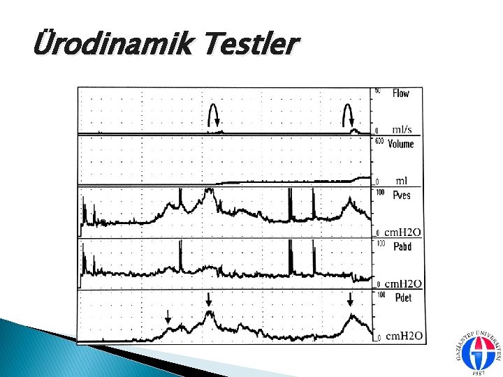 Ürodinamik Testler 