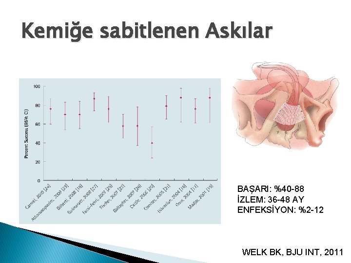 Kemiğe sabitlenen Askılar BAŞARI: %40 -88 İZLEM: 36 -48 AY ENFEKSİYON: %2 -12 WELK