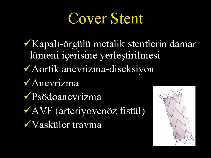 Cover Stent üKapalı-örgülü metalik stentlerin damar lümeni içerisine yerleştirilmesi üAortik anevrizma-diseksiyon üAnevrizma üPsödoanevrizma üAVF