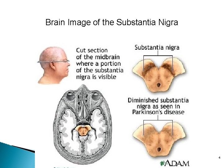 Brain Image of the Substantia Nigra 4 