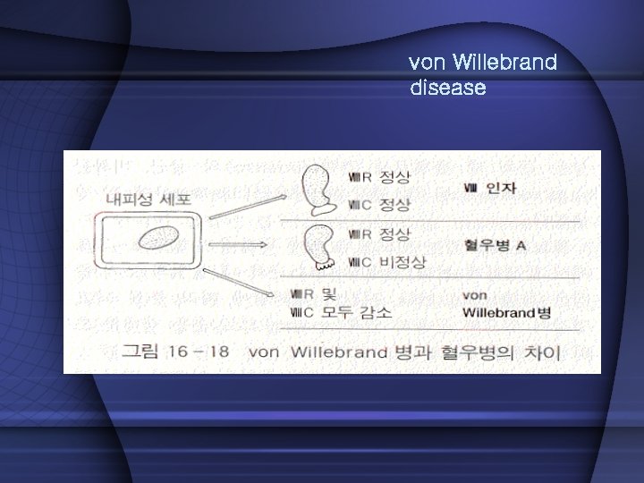 von Willebrand disease 