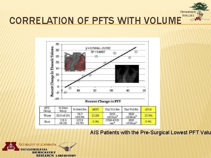 CORRELATION OF PFTS WITH VOLUME AIS Patients with the Pre-Surgical Lowest PFT Valu USCULOSKELETAL