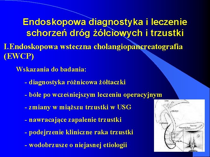 Endoskopowa diagnostyka i leczenie schorzeń dróg żółciowych i trzustki I. Endoskopowa wsteczna cholangiopancreatografia (EWCP)