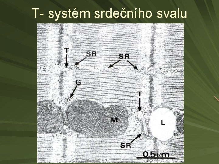 T- systém srdečního svalu 