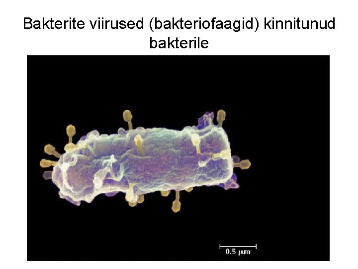 Bakterite viirused (bakteriofaagid) kinnitunud bakterile 