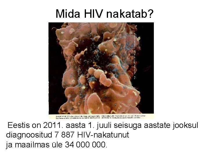Mida HIV nakatab? Eestis on 2011. aasta 1. juuli seisuga aastate jooksul diagnoositud 7