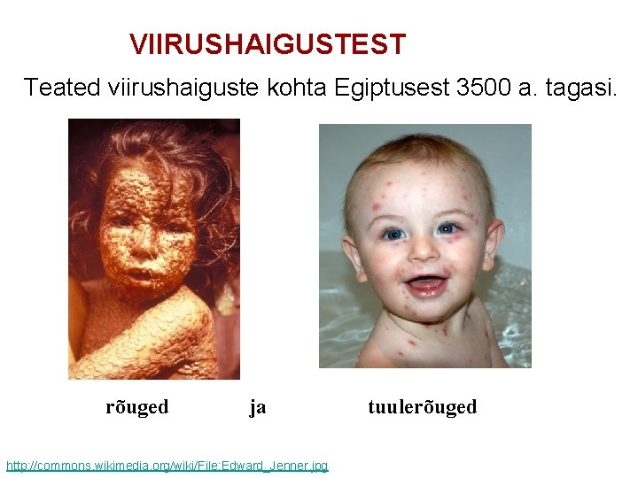 VIIRUSHAIGUSTEST Teated viirushaiguste kohta Egiptusest 3500 a. tagasi. rõuged ja http: //commons. wikimedia. org/wiki/File: