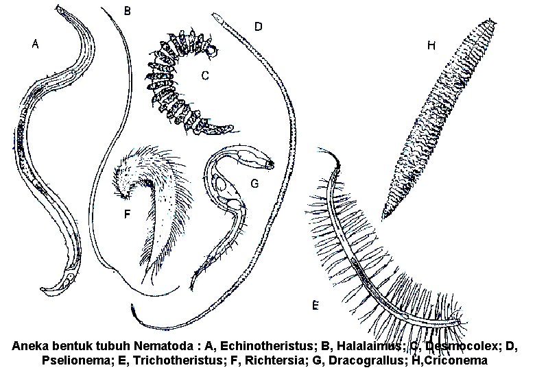 Aneka bentuk tubuh Nematoda : A, Echinotheristus; B, Halalaimus; C, Desmocolex; D, Pselionema; E,