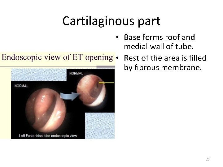 Cartilaginous part • Base forms roof and medial wall of tube. • Rest of