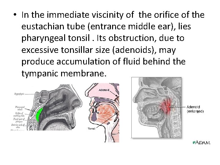  • In the immediate viscinity of the orifice of the eustachian tube (entrance