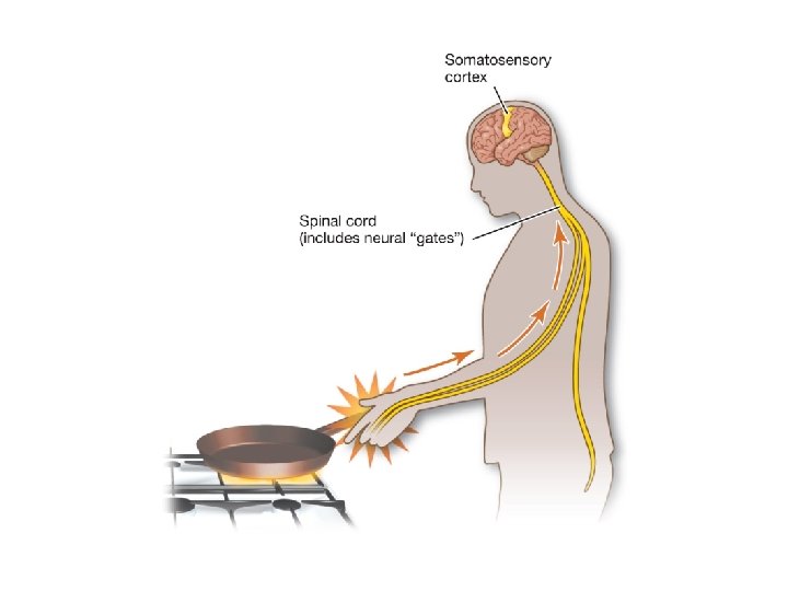 Diagram to demonstrate gate control theory with neural gates in the spinal cord Diagram to demonstrate gate control theory with neural gates in the spinal cord