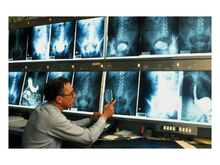 Radiologist looking at a series of scans of a human's abdomen region Radiologist looking at a series of scans of a human's abdomen region
