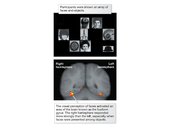Brain scan that highlights regions with increased activity when viewing people's faces Brain scan that highlights regions with increased activity when viewing people's faces