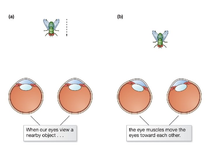 Image A depicts a diagram of eyes which aim out at parallel lines when Image A depicts a diagram of eyes which aim out at parallel lines when
