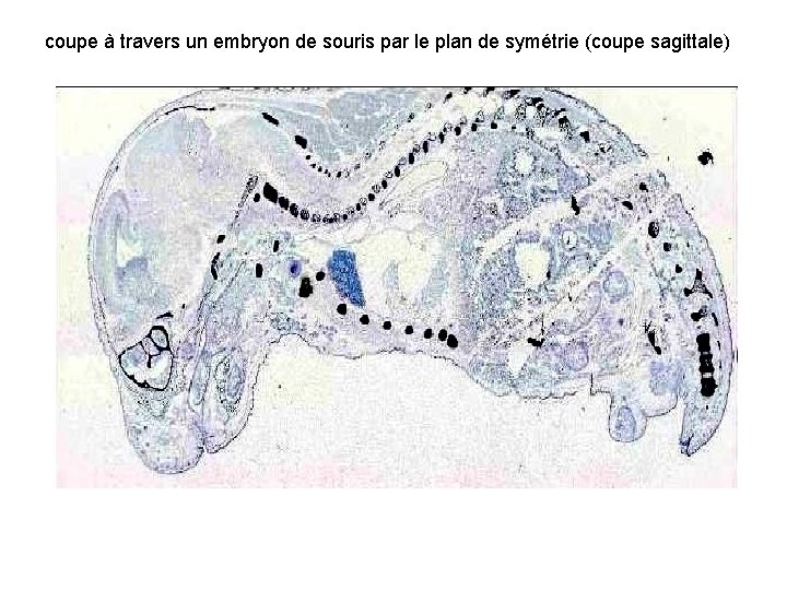 coupe à travers un embryon de souris par le plan de symétrie (coupe sagittale)