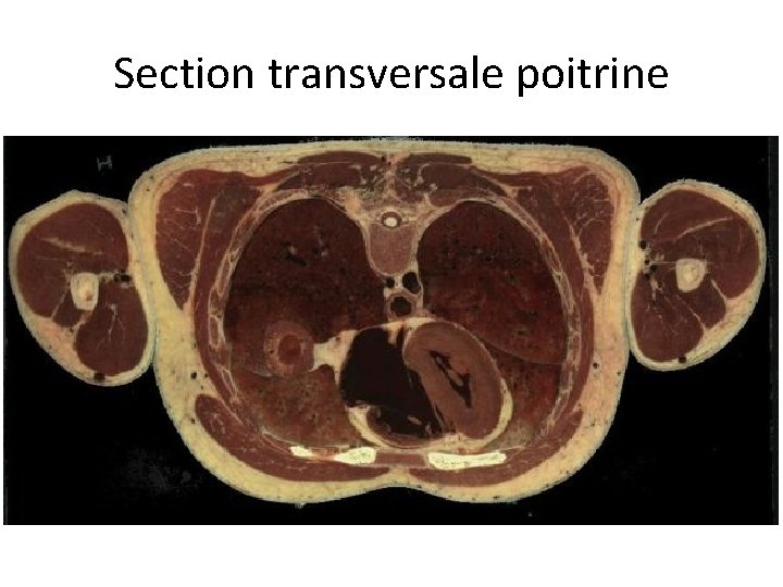 Section transversale poitrine 