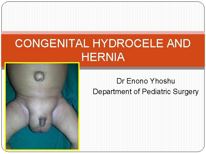 CONGENITAL HYDROCELE AND HERNIA Dr Enono Yhoshu Department of Pediatric Surgery 