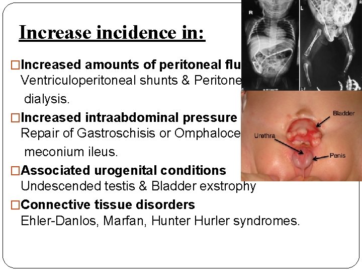 Increase incidence in: �Increased amounts of peritoneal fluid Ventriculoperitoneal shunts & Peritoneal dialysis. �Increased