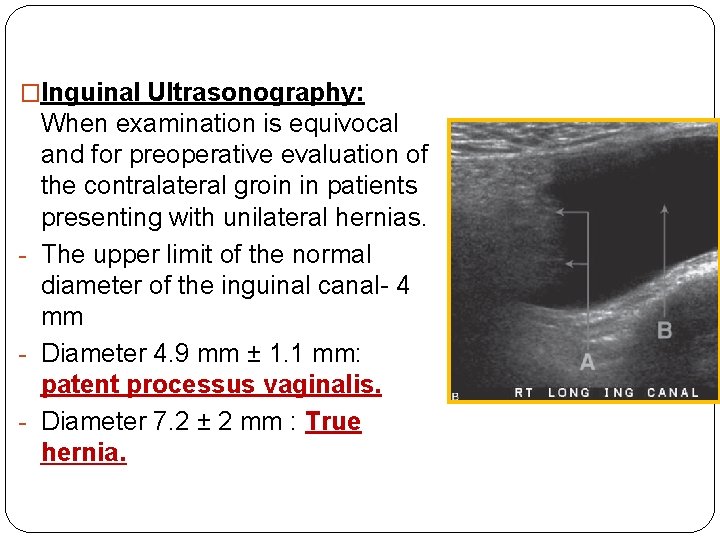 �Inguinal Ultrasonography: When examination is equivocal and for preoperative evaluation of the contralateral groin