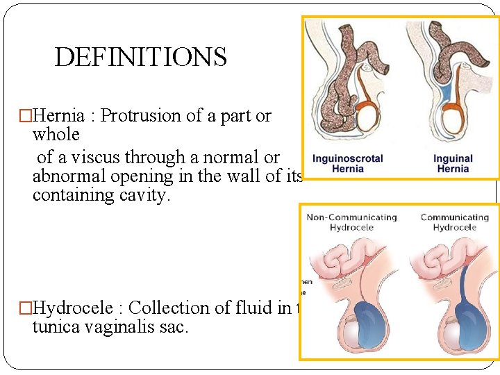 DEFINITIONS �Hernia : Protrusion of a part or whole of a viscus through a