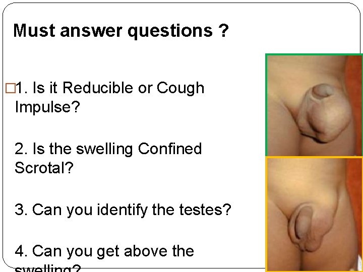 Must answer questions ? � 1. Is it Reducible or Cough Impulse? 2. Is