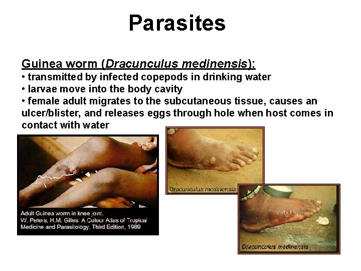 Parasites Guinea worm (Dracunculus medinensis): • transmitted by infected copepods in drinking water •