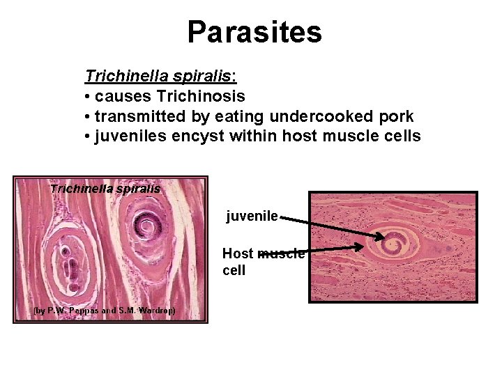 Parasites Trichinella spiralis: • causes Trichinosis • transmitted by eating undercooked pork • juveniles