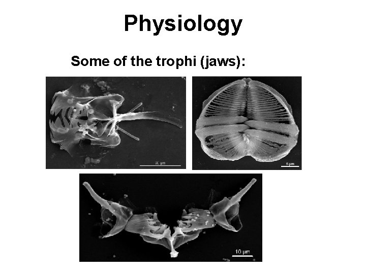 Physiology Some of the trophi (jaws): 