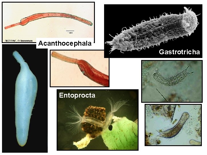 Acanthocephala Gastrotricha Entoprocta 