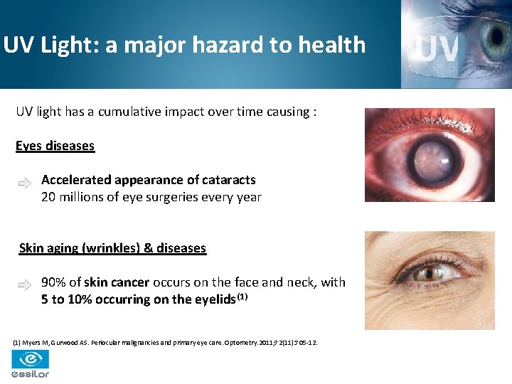 UV Light: a major hazard to health UV light has a cumulative impact over