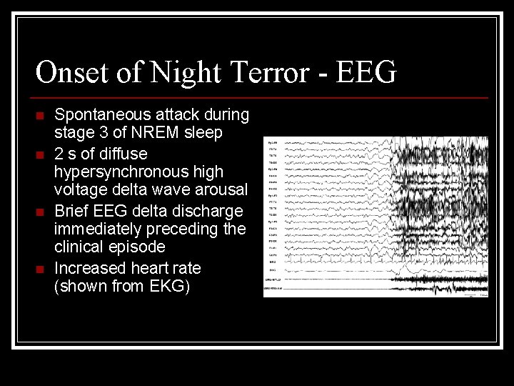 Onset of Night Terror - EEG n n Spontaneous attack during stage 3 of