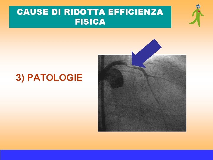 CAUSE DI RIDOTTA EFFICIENZA FISICA 3) PATOLOGIE CAUSE DI RIDOTTA EFFICIENZA FISICA 3) PATOLOGIE
