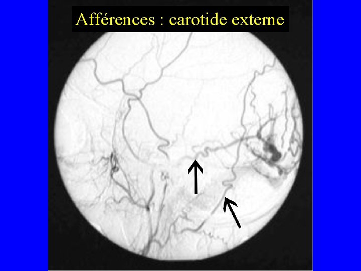 Afférences : carotide externe 