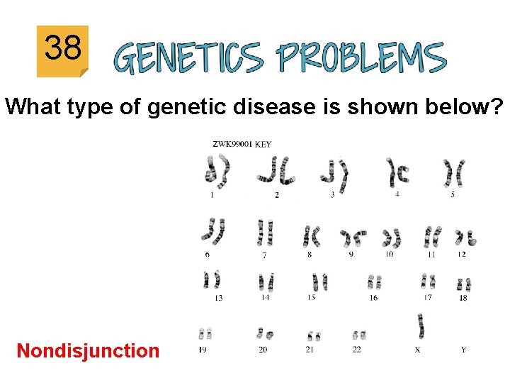 38 What type of genetic disease is shown below? Nondisjunction 