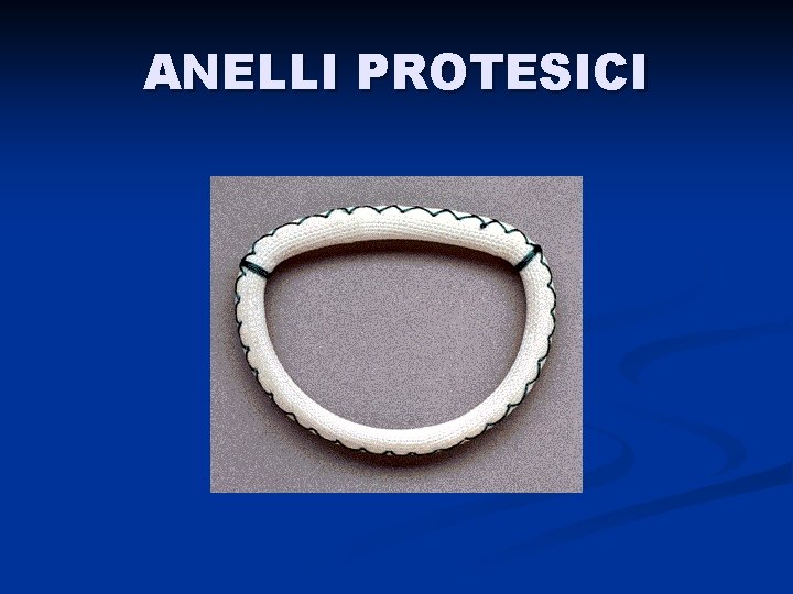 ANELLI PROTESICI 