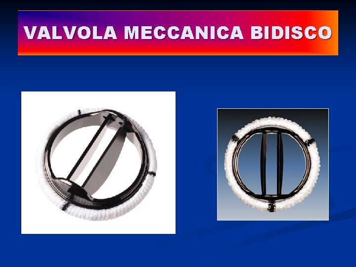VALVOLA MECCANICA BIDISCO 