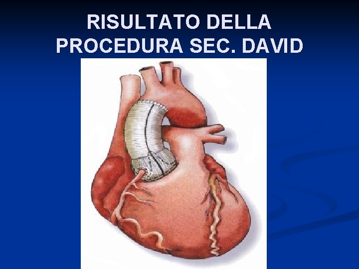 RISULTATO DELLA PROCEDURA SEC. DAVID 