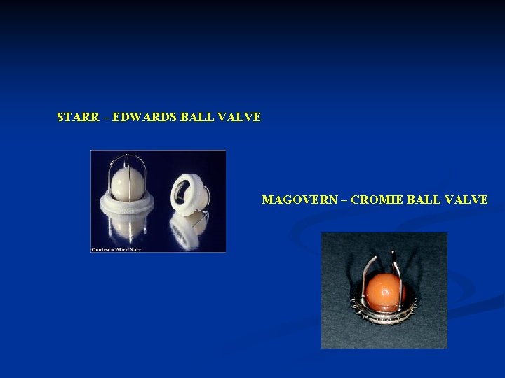 STARR – EDWARDS BALL VALVE MAGOVERN – CROMIE BALL VALVE 