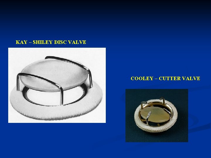 KAY – SHILEY DISC VALVE COOLEY – CUTTER VALVE 