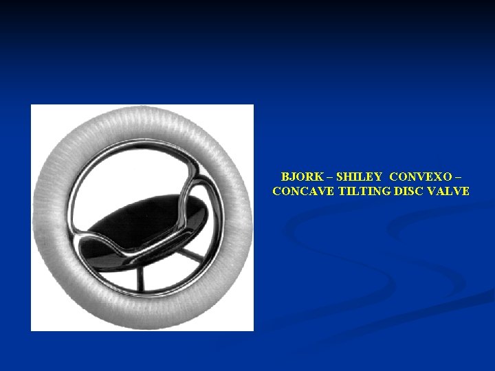 BJORK – SHILEY CONVEXO – CONCAVE TILTING DISC VALVE 