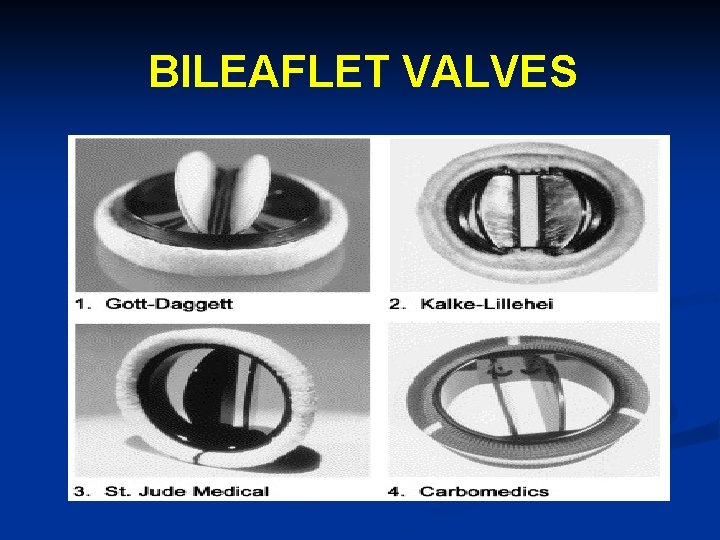 BILEAFLET VALVES 