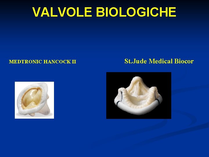 VALVOLE BIOLOGICHE MEDTRONIC HANCOCK II St. Jude Medical Biocor 