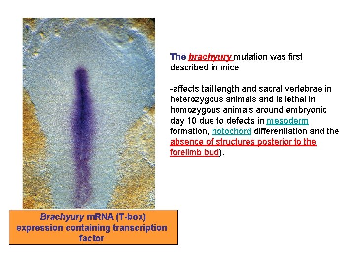 The brachyury mutation was first described in mice -affects tail length and sacral vertebrae