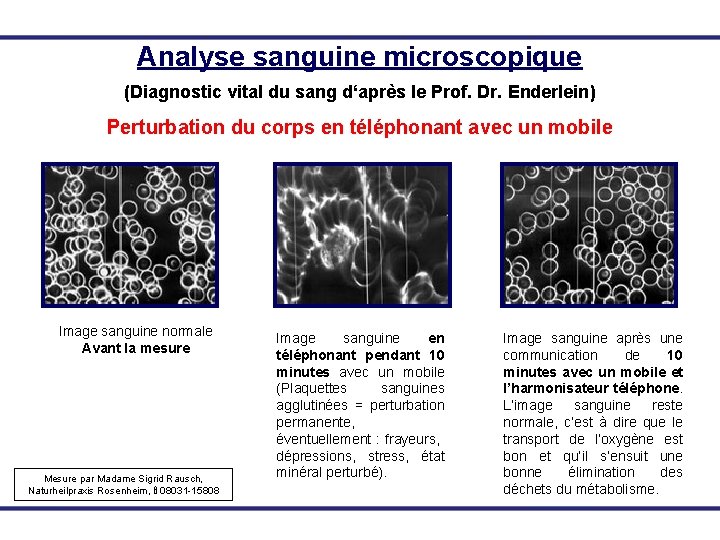 Analyse sanguine microscopique (Diagnostic vital du sang d‘après le Prof. Dr. Enderlein) Perturbation du