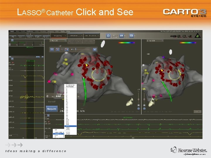 LASSO® Catheter Click and See 