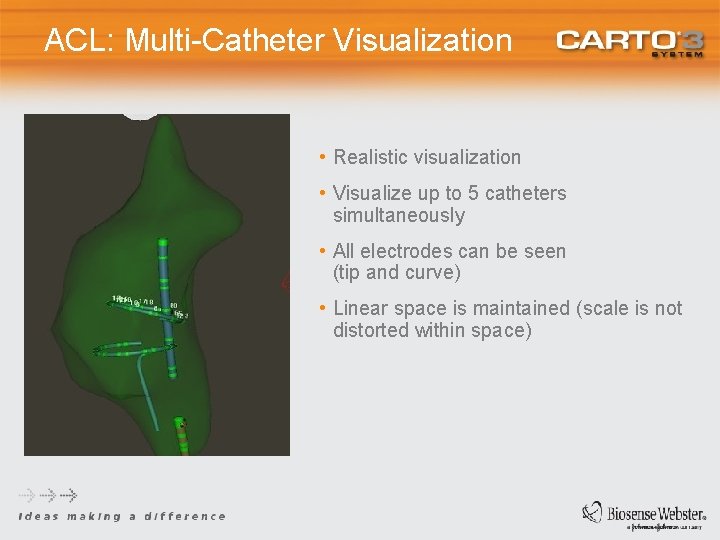 ACL: Multi-Catheter Visualization • Realistic visualization • Visualize up to 5 catheters simultaneously •