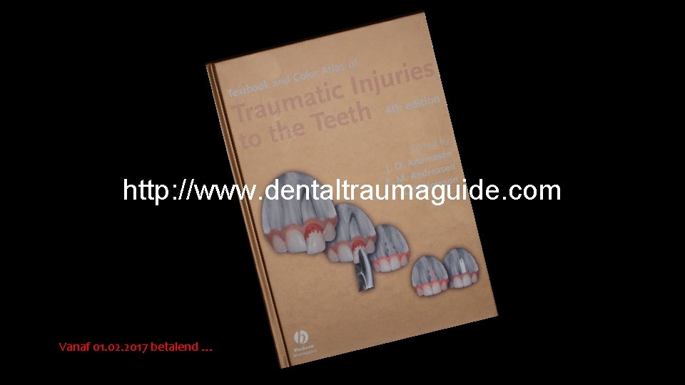http: //www. dentaltraumaguide. com Vanaf 01. 02. 2017 betalend … 