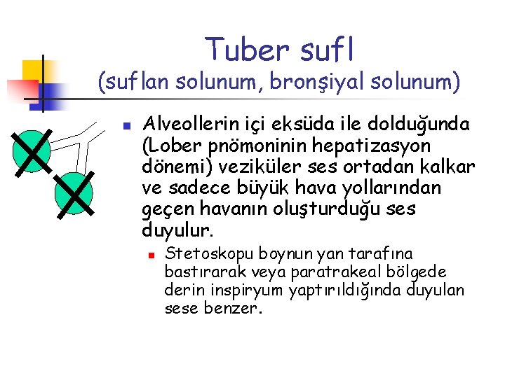 Tuber sufl (suflan solunum, bronşiyal solunum) n Alveollerin içi eksüda ile dolduğunda (Lober pnömoninin