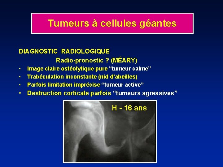 Tumeurs à cellules géantes DIAGNOSTIC RADIOLOGIQUE Radio-pronostic ? (MÉARY) • • • Image claire